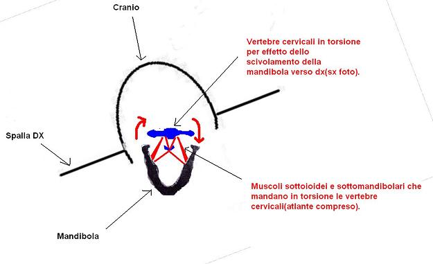 Cervicale1.jpg