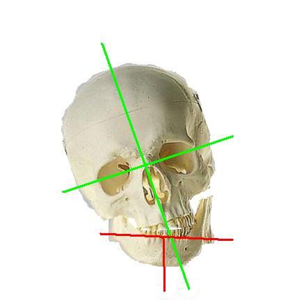 cranioinclinatook1ok1.jpg